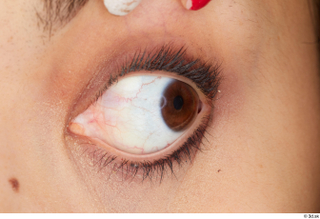 Amal eye 0011.jpg